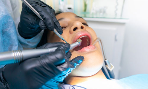Top Tooth Extraction In Chicago