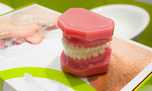What is the Average Cost of Full Mouth Dentures