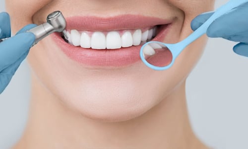 dental implants trends