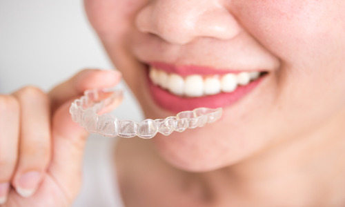 How Much Do Clear Aligners Cost