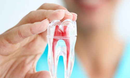 what are the symptoms of failed root canal